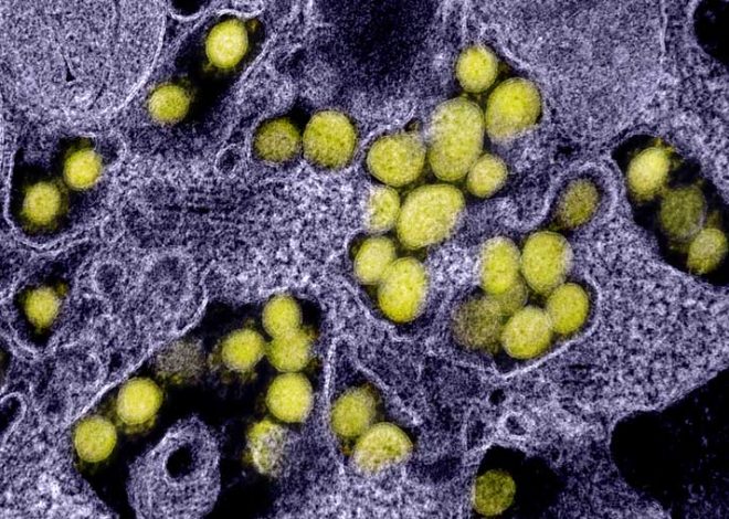 Disease detectives track an invisible virus